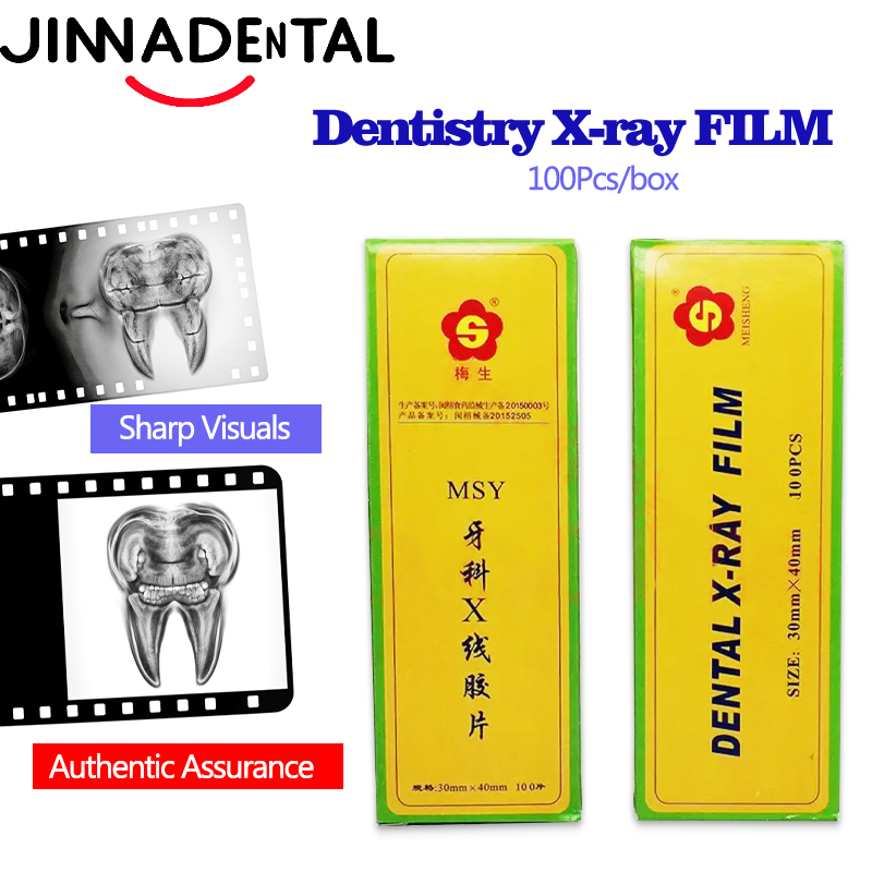 Xlab Medical - 30*40mm Tandheelkunde Röntgenfilm Mondholte Medische Beeldfilms