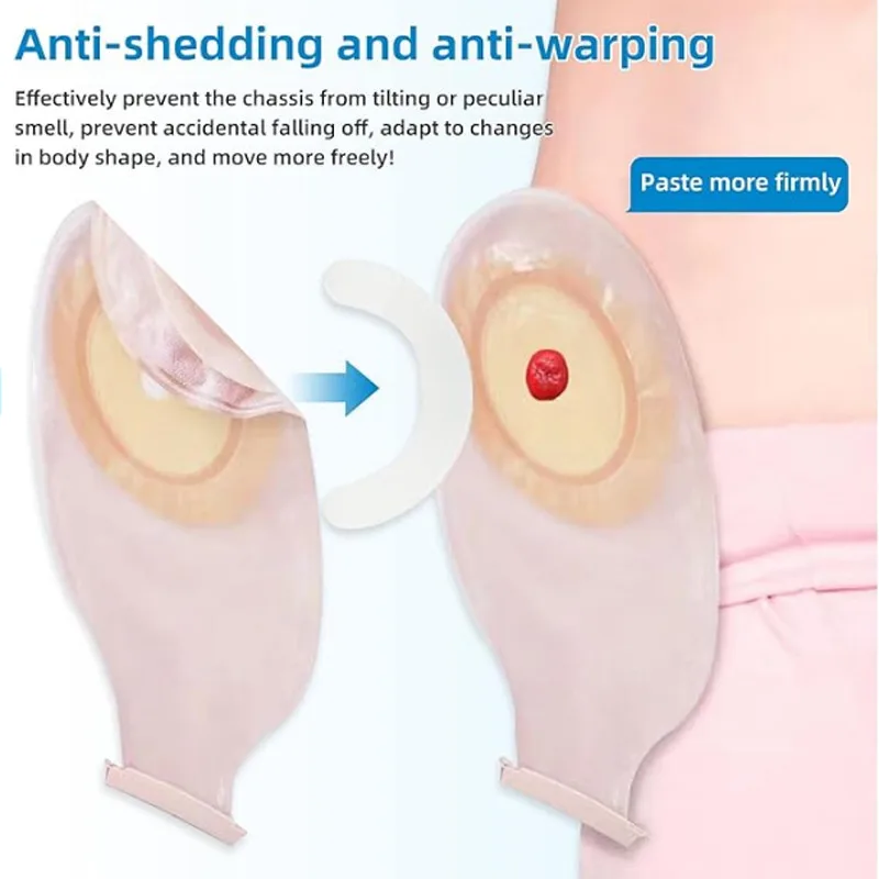 Medical Tape - Medische stomazak verstevigingsstrip elastische drukgevoelige tape